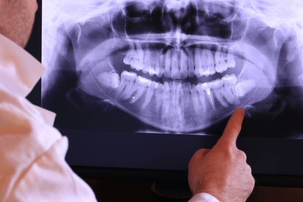 Best Tooth Pain Emergency Relief  in Holbrook, AZ